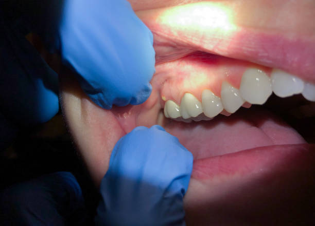 Best Emergency Cosmetic Dentistry in South Sumter, SC